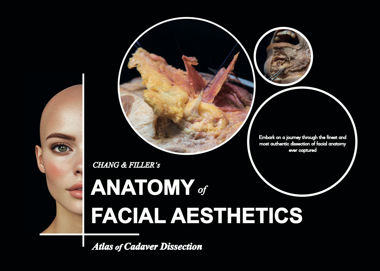 Chang & Filler's Anatomy of facial aesthetics