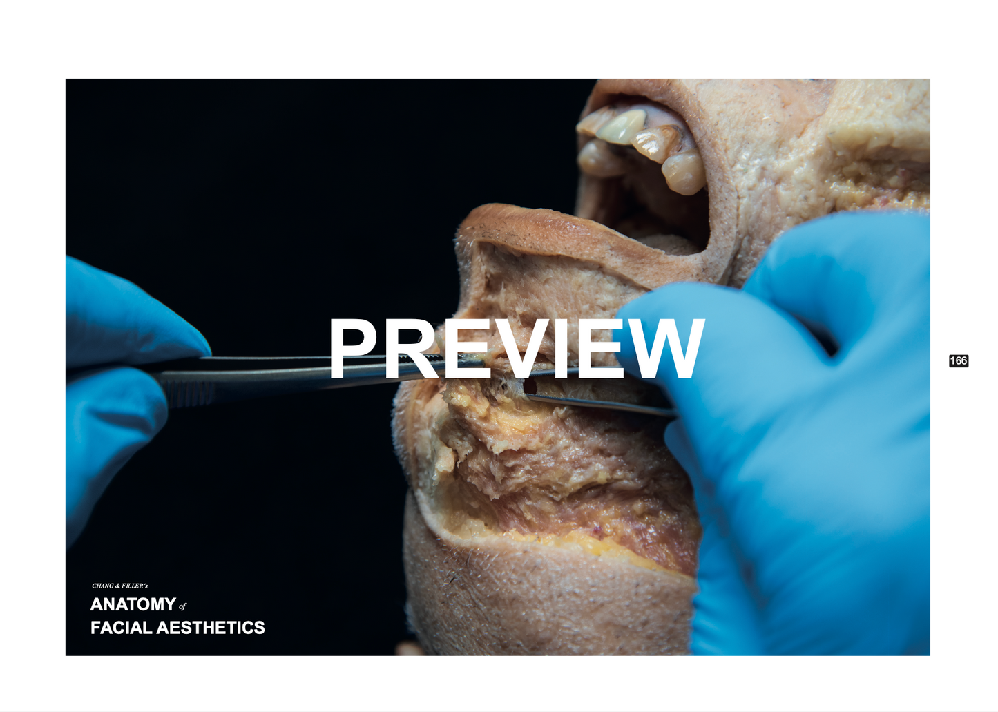 Chang & Filler's Anatomy of facial aesthetics