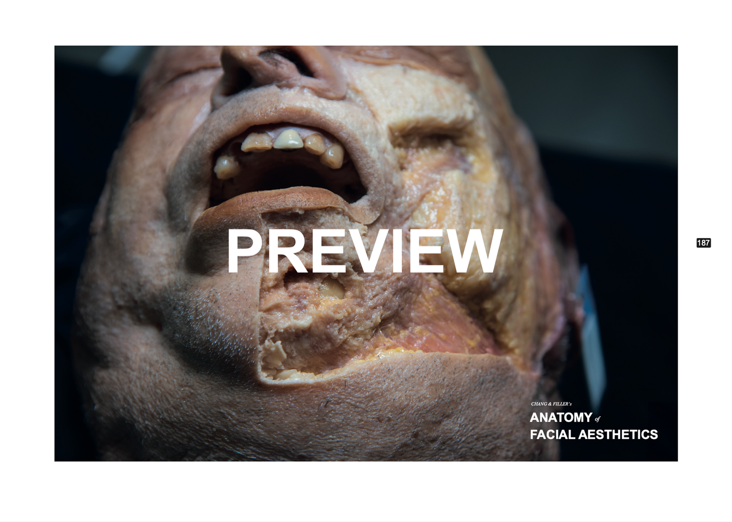 Chang & Filler's Anatomy of facial aesthetics