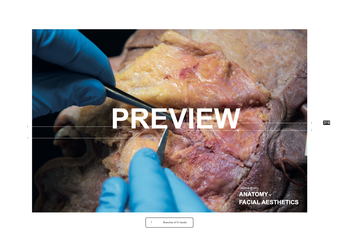 Chang & Filler's Anatomy of facial aesthetics